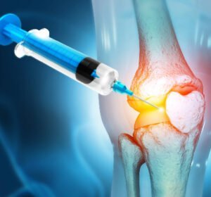 Intra articular injections for joints